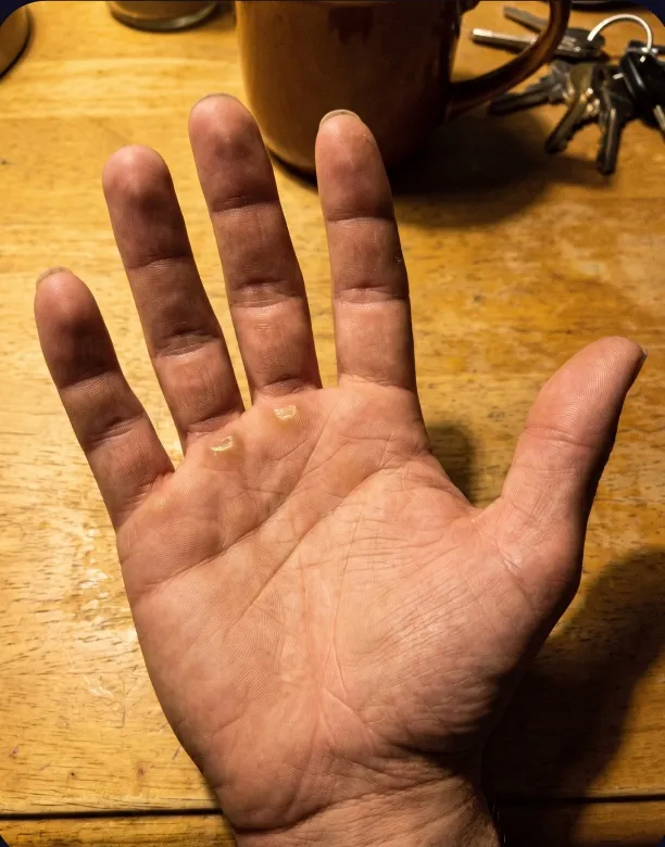 A hand resting on a table beside a set of keys